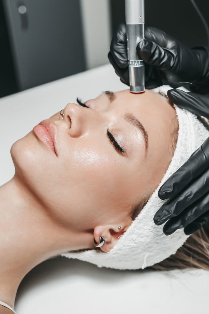Close-up of a woman receiving a microneedling treatment at Liv Med Spa, Sioux Falls.