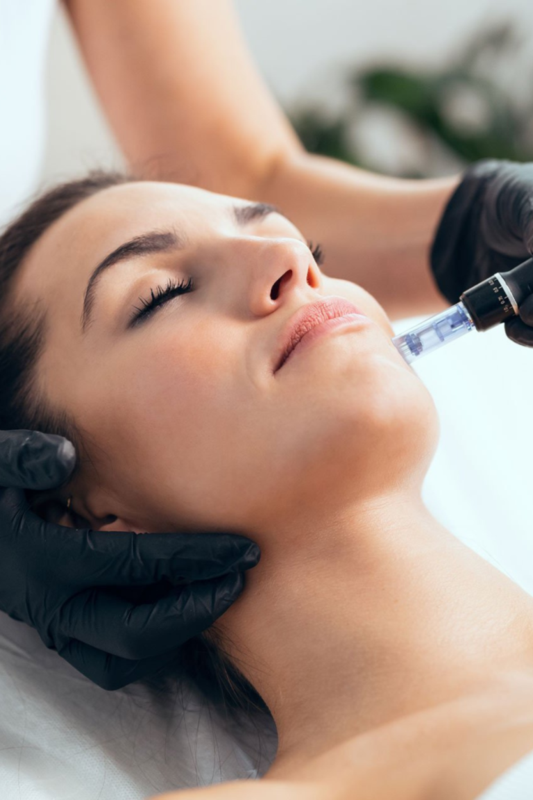 Woman receiving a microneedling treatment on her face